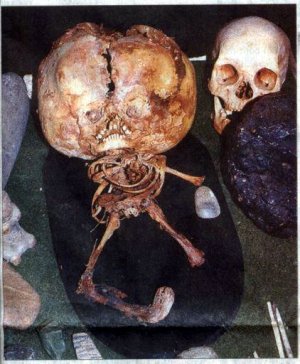 brazil-star-child-skull-skeleton copy.jpg
